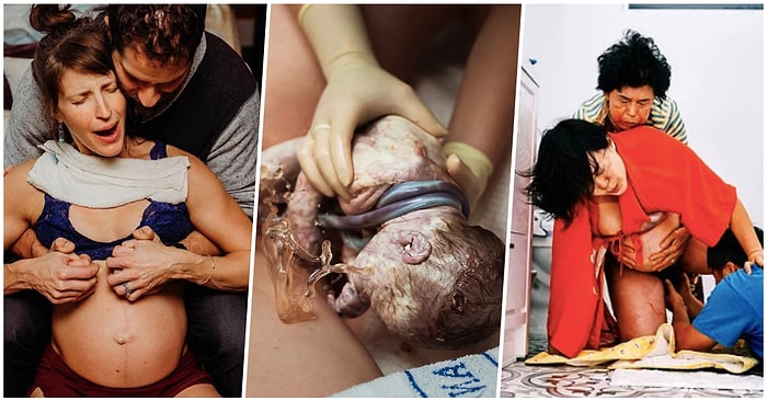 Dışarıdan Gözüktüğü Gibi Değilmiş! Doğum Esnasında ve Sonrasında Çekilmiş En Çarpıcı 19 Fotoğraf