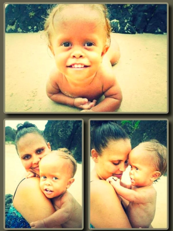 Quaden'ın annesi Yarraka Bayles de sosyal medya hesabında, 2012 yılında 15 aylık olduğunu söylediği Quaden'ın fotoğraflarını paylaştı.