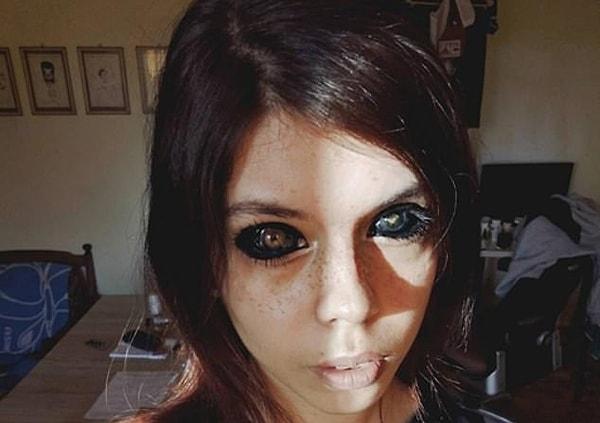 25 yaşındaki Polonyalı kadın, Aleksandra Sadowska gözünün beyaz kısımlarını siyah renge boyattıktan sonra kör oldu.