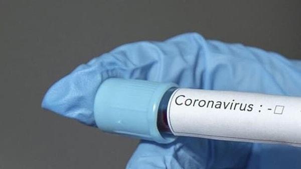 1. Öncelikle Koronavirüs şüphesi ile sağlık ocağına başvurabilir miyiz?