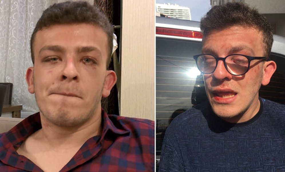 Otizmli Genç, Kız Arkadaşına Laf Attığını İddia Eden Biri Tarafından Darp Edildi: 'Vurma Ben Engelliyim!'