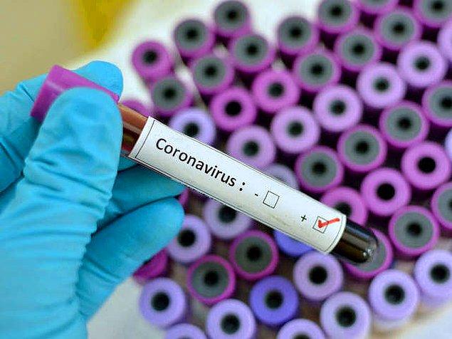 Koronavirüs, yeni ismiyle Covid-19 tüm dünyayı sardı.
