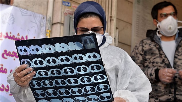 İran'da son 24 saatte 75 kişi hayatını kaybetti