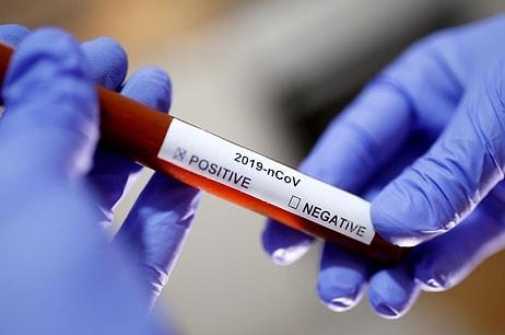 Hangi Ülkede Kaç Kişiye Koronavirüs Testi Yapıldı?