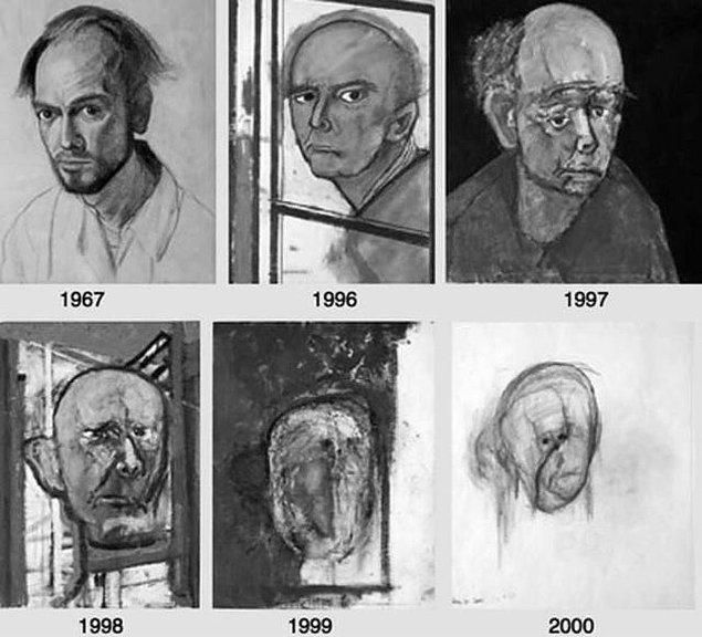 6. Bir alzaymır hastasının kendi portresini çizmesi... Yılların geçişinin yarattığı değişim trajik.