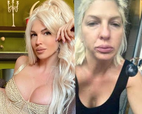 Инстаграмеры, которые даже не замечают, что перебарщивают с фотошопом