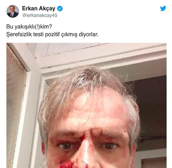 MHP Grup Başkanvekili Erkan Akçay dayak yiyen Kumbasar'ın fotoğrafını paylaştı