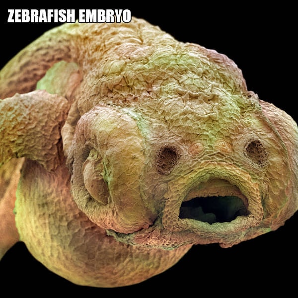 11. Эмбрион рыбы Данио