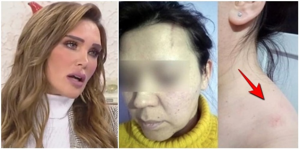 Özbek Yardımcısını Sevgilisiyle Darp Edip Ormana Bırakmakla Suçlanan Seren Serengil İddialara Cevap Verdi