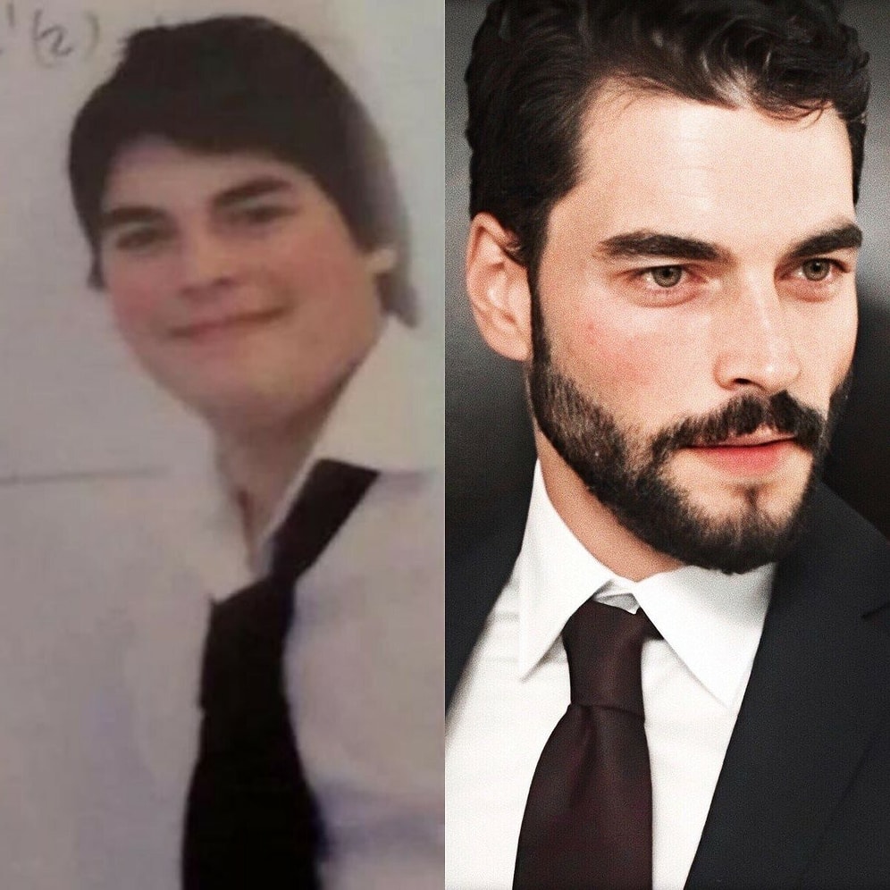 Из пухликов в атлеты: турецкие звезды, которые сильно похудели