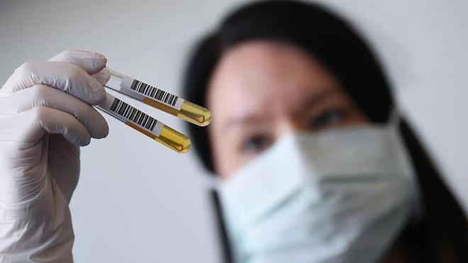 İyileşen Hastaların Yeniden Enfekte Olduğunu Açıklayan Güney Kore'den Geri Adım: PCR Testi Yanıltmış