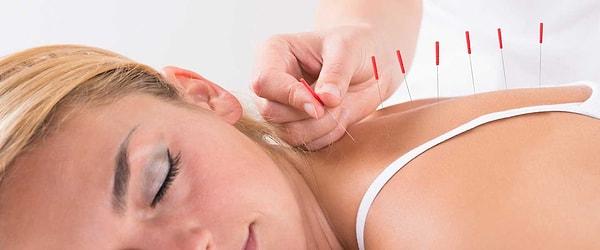 Akupunktur tedavisi orucu bozar mı?
