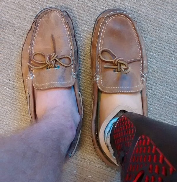 15. "Normal ayağım ile protez ayağımın ayakkabıda bıraktığı izler arasındaki fark."