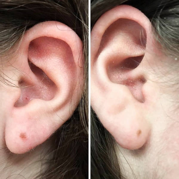 9. «У моей подруги маленькие веснушки на обеих мочках ушей, которые напоминают серьги».