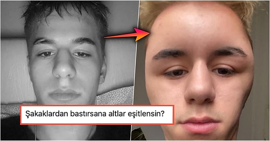 Saçlarını Boyattıktan Sonra Boyaya Alerjisi Olduğunu Acı Şekilde Öğrenen Çocuğa Gelen Birbirinden Komik Yorumlar