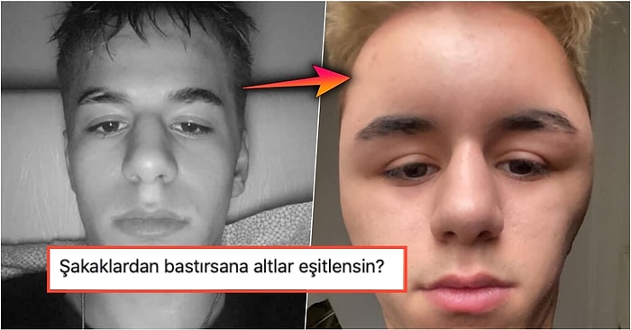 Saçlarını Boyattıktan Sonra Boyaya Alerjisi Olduğunu Acı Şekilde Öğrenen Çocuğa Gelen Birbirinden Komik Yorumlar