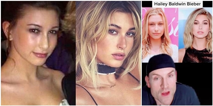 Hailey Bieber, Bugüne Dek Hiç Estetik Yaptırmadığını Açıklayarak Estetikli Olduğunu İddia Eden Bir Doktoru Mahkemeye Verdi