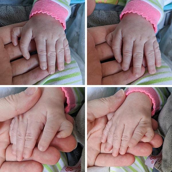 2. "En küçük kızım Şubat ayında fazladan parmaklarla doğdu."