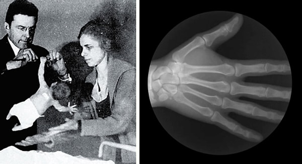 3. Если ребенок схватит металлический стержень, он может неустанно висеть на нем в течение длительного времени!
