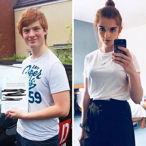 11. "В 2014 году до изменения и после 5 месяцев гормональной терапии"