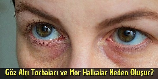 Neden Böyle Olduklarına Dair Aklınızı Sürekli Kurcalayan 12 Soruyu Cevaplıyoruz!