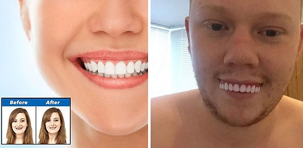 11. Не покупайте виниры онлайн