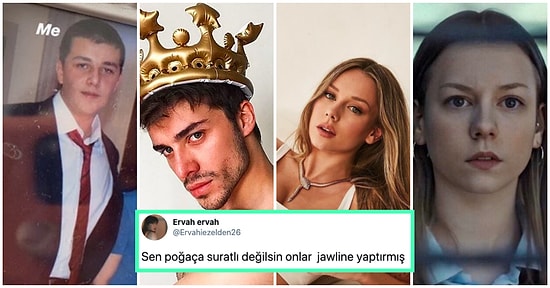 Yüz Hatlarını Yeniden Yaratan Jawline Çene Dolgusu Yaptırarak Eski Sevgililerini Üzüntüden Hastanelik Eden 21 Kişi