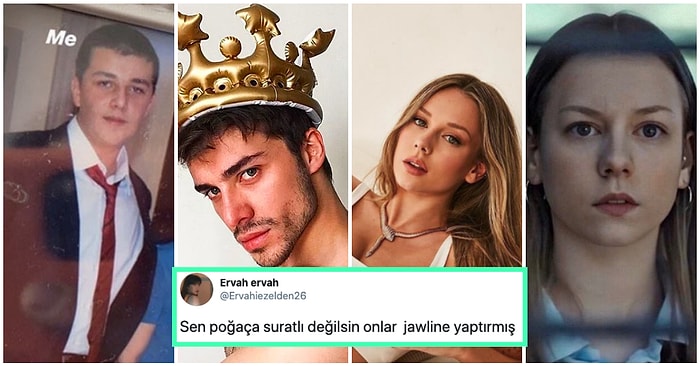 Yüz Hatlarını Yeniden Yaratan Jawline Çene Dolgusu Yaptırarak Eski Sevgililerini Üzüntüden Hastanelik Eden 21 Kişi