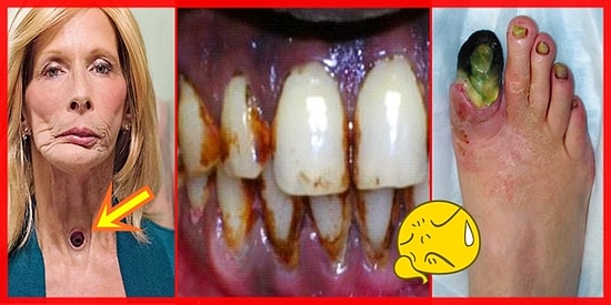 Neden Sigarayı Bırakman Gerektiğini Gözüne Gözüne Sokacak 11 Fotoğraf