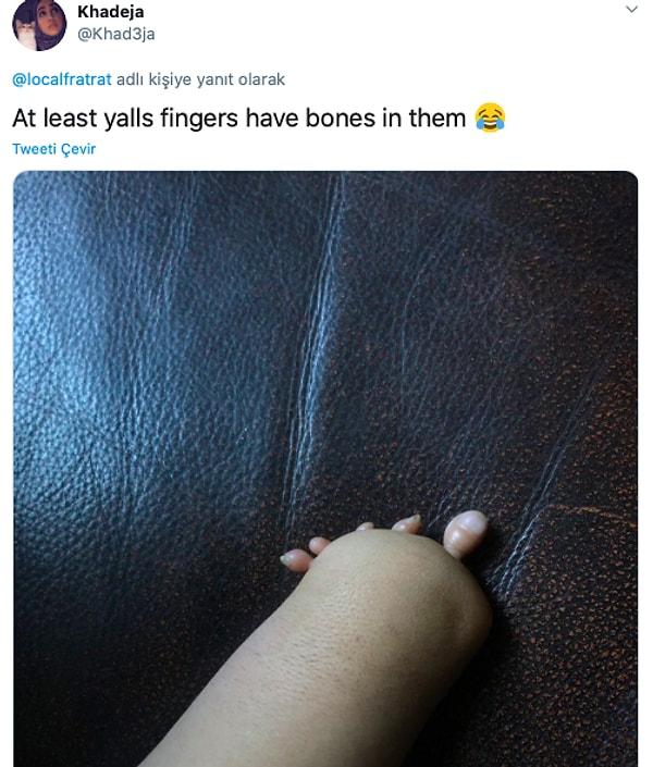 "En azından parmaklarınızın kemikleri var. 😂"