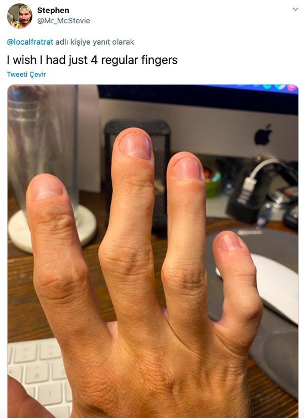 "Keşke dört tane normal parmağım olsaydı."
