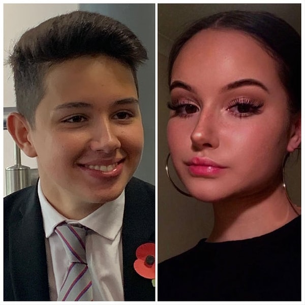 15. "После трех лет гормональной терапии. Фото в 16 лет и в 19"