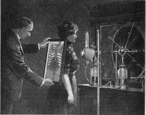 1920'lerde X-ray cihazı güzellik uygulamaları için kullanılıyordu.