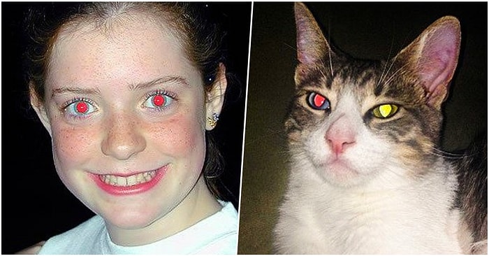 Her Ne Kadar Tek Amacı Canınızı Sıkmakmış Gibi Görünse de Aslında Birer Açıklaması Olan Sinir Bozucu Durumlar