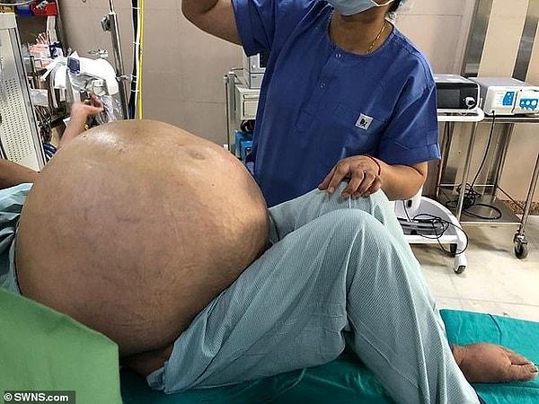 Adının duyulmasını istemeyen 52 yaşındaki kadın, sürekli kilo aldığı ve karnında bir şişlik olduğunu söyleyerek doktora gitti.