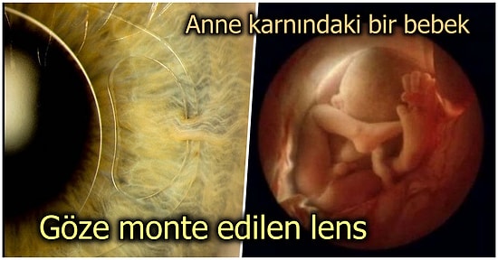 Bilim Meraklılarını Hayretler İçinde Bırakacak Muhtemelen Daha Önce Hiç Görmediğiniz 21 Görsel