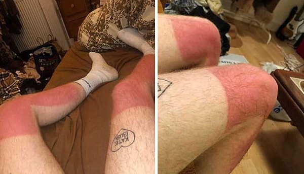 6. Когда люди спрашивают меня, почему я хочу сидеть в тени, я показываю им эти фотографии