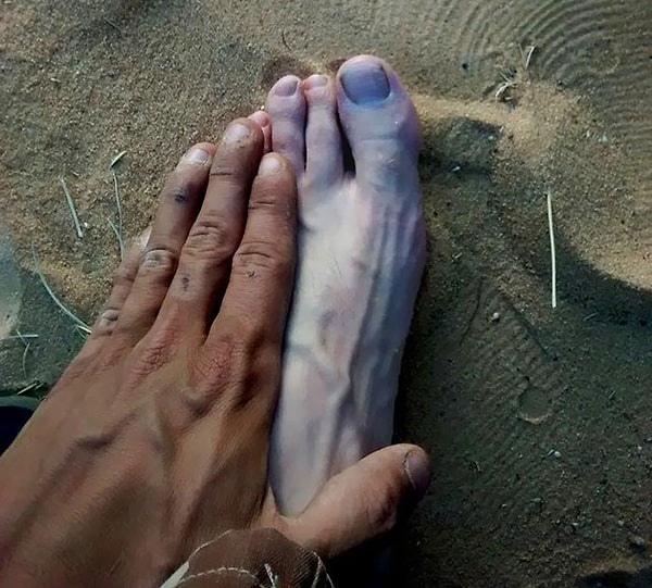 7. Загар моей руки по сравнению с моей ногой