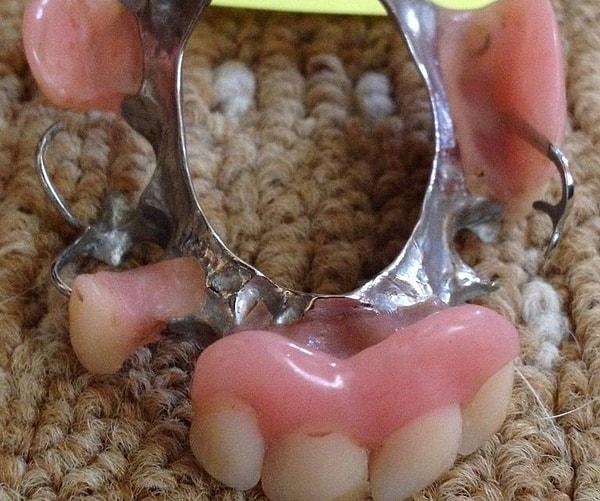 10. Kullanılmış takma diş...