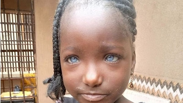 30-летняя Рисикат говорит в интервью, что ее муж начал относиться к ней по-другому, особенно после того, как ее двое детей родились такими же голубоглазыми, как она.