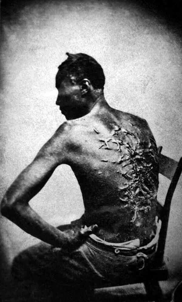 7. Eski bir kölenin yaraları, 1863.