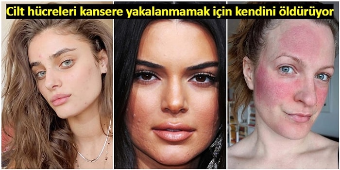 Cildiniz Size Bir Şeyler Anlatmaya Çalışıyor: Sıkça Görülen Cilt Problemleri Aslında Ne Anlama Geliyor?