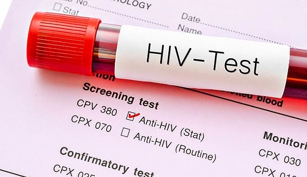 13. Во второй раз в мире вылечился пациент с ВИЧ-инфекцией.