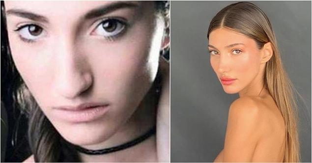 2018 Miss Turkey güzeli Şevval Şahin estetikleriyle çok tartışılmıştı.