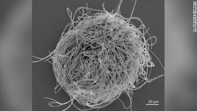 0,59 mm büyüklüğündeki dişi myanmarcypris huinin içinde dört yumurta ve seminal yuvalarında bir sperm tespit edildi.
