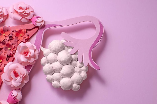 10 kadından 1'inde görülen bu rahatsızlık kan testinde çıkan hormonsal bozukluklara göre doğum kontrol hapları veya adet düzenleyici ilaçlar ile tedavi edilebiliyor.
