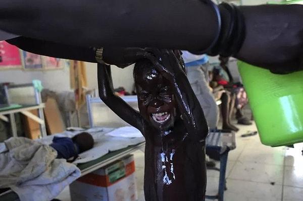 7. Yuvasından edilen Sudanlı çocuk yıkanıyor.