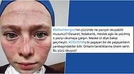 Saatlerce Koruyucu Ekipman ve Maskeyle Çalıştıktan Sonra Yüzünün Geldiği Hali Paylaşan Seher Hemşirenin İsyanına Kulak Verin
