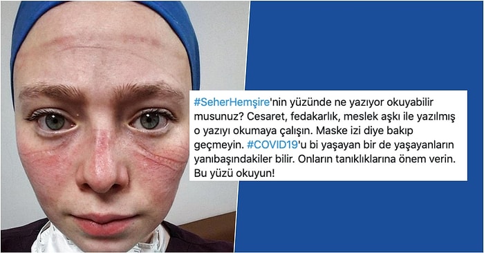 Saatlerce Koruyucu Ekipman ve Maskeyle Çalıştıktan Sonra Yüzünün Geldiği Hali Paylaşan Seher Hemşirenin İsyanına Kulak Verin