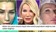 Estetiğin de Bu Kadarı... Yüzünü Fransız Askı Yöntemiyle İple Gerdiren Seda Sayan'ın Görüntüleri Herkesi Gerdi!